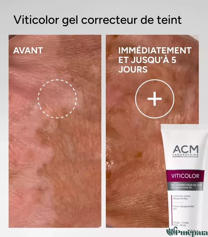 ACM Viticolor Gel correcteur de teint 50 ML - Image 4